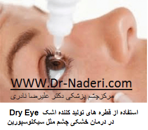 Dry Eye استفاده از قطره های تولید کننده اشک در درمان خشکی چشم