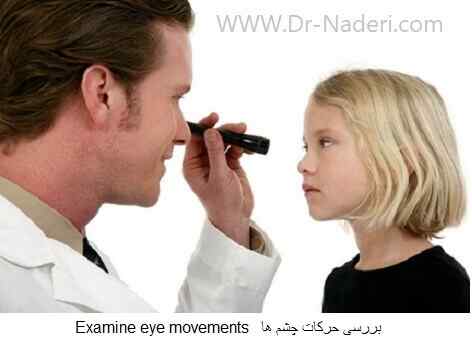 Examine eye movementsبررسی حرکات چشم 