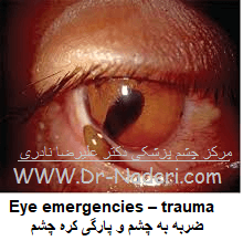 Eye emergencies - traumaضربه به چشم و پارگی کره چشم