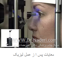 LASIK Eye Examination معاینات پس از عمل لیزیک