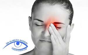  Ocular migraine میگرن چشمی
