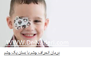 strabismus treatment درمان انحراف چشم