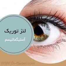 لنز توریک