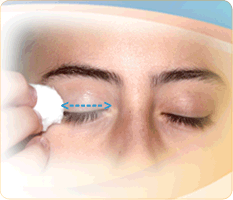 eyelid hygeine بهداشت پلک
