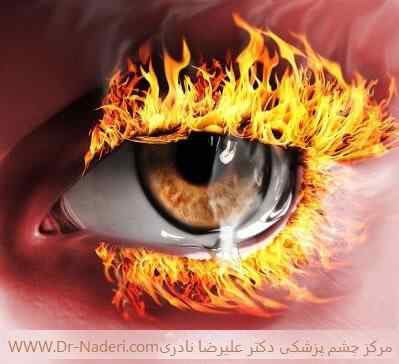 fire_eye_by_bevrnja چهار شنبه سوری