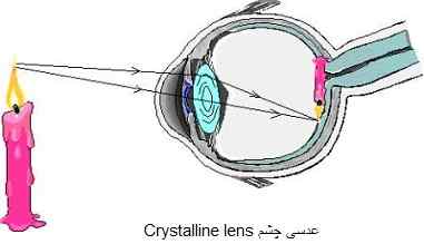 عدسی چشم Crystalline lens
