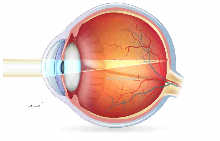 Crystalline lensعدسی چشم 