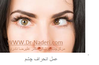 strabismus surgery جراحی انجراف چشم